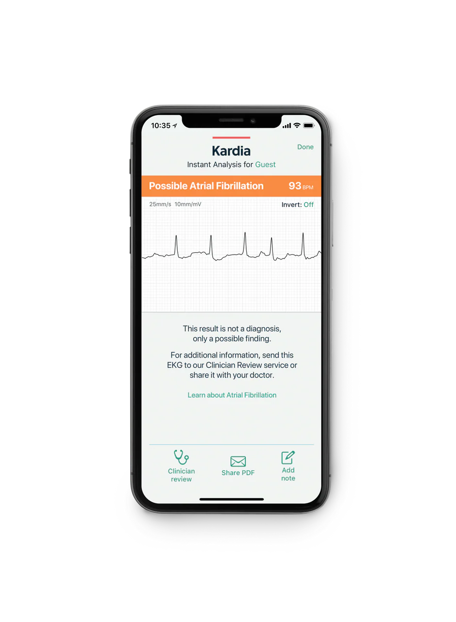 Alivecor KardiaMobile Single Lead ECG Heart Monitor - Image 5