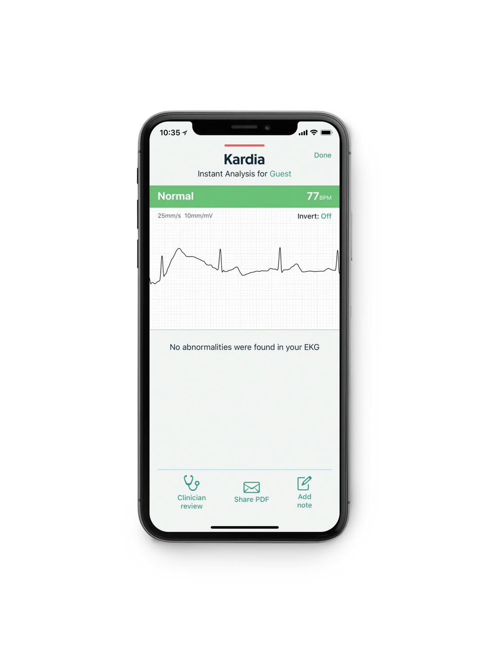 Alivecor KardiaMobile Single Lead ECG Heart Monitor - Image 6