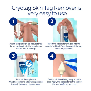 Cryotag Skin Tag Remover 12 Treatments - Image 3