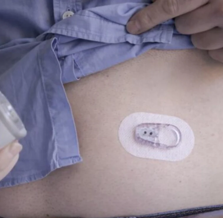 Dexcom ONE Sensor - 10 Days Supply - Image 3