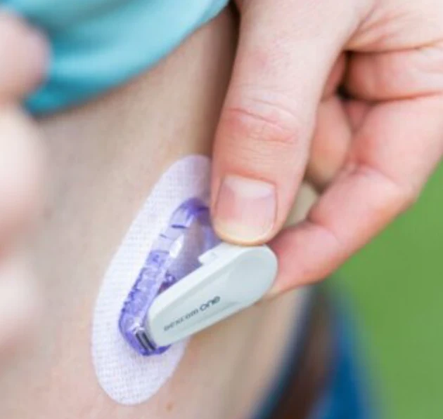 Dexcom ONE Transmitter - Image 3
