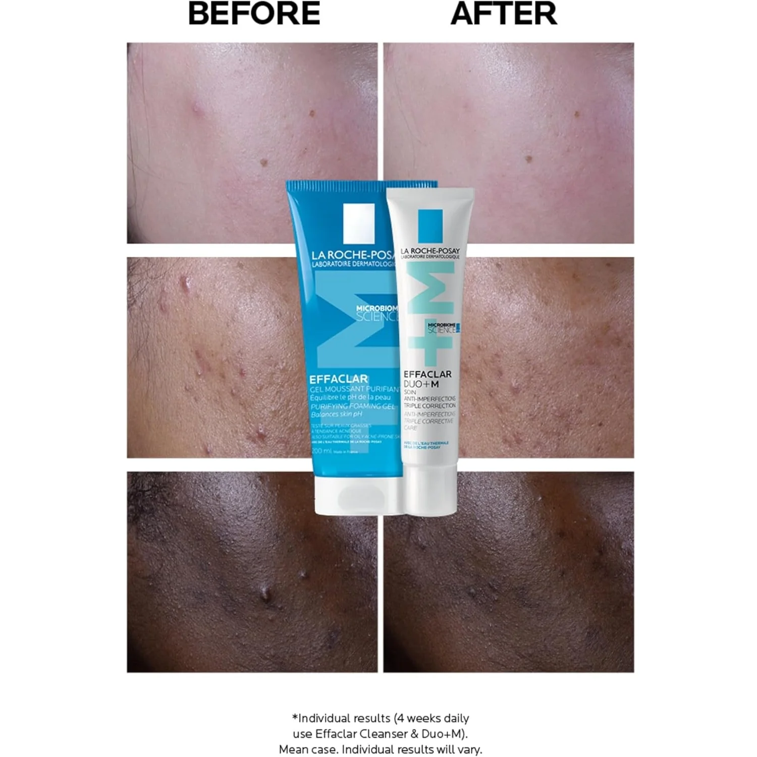 La Roche Posay Effaclar Duo+M Anti Blemish Corrective Moisturiser 40ml - Image 2