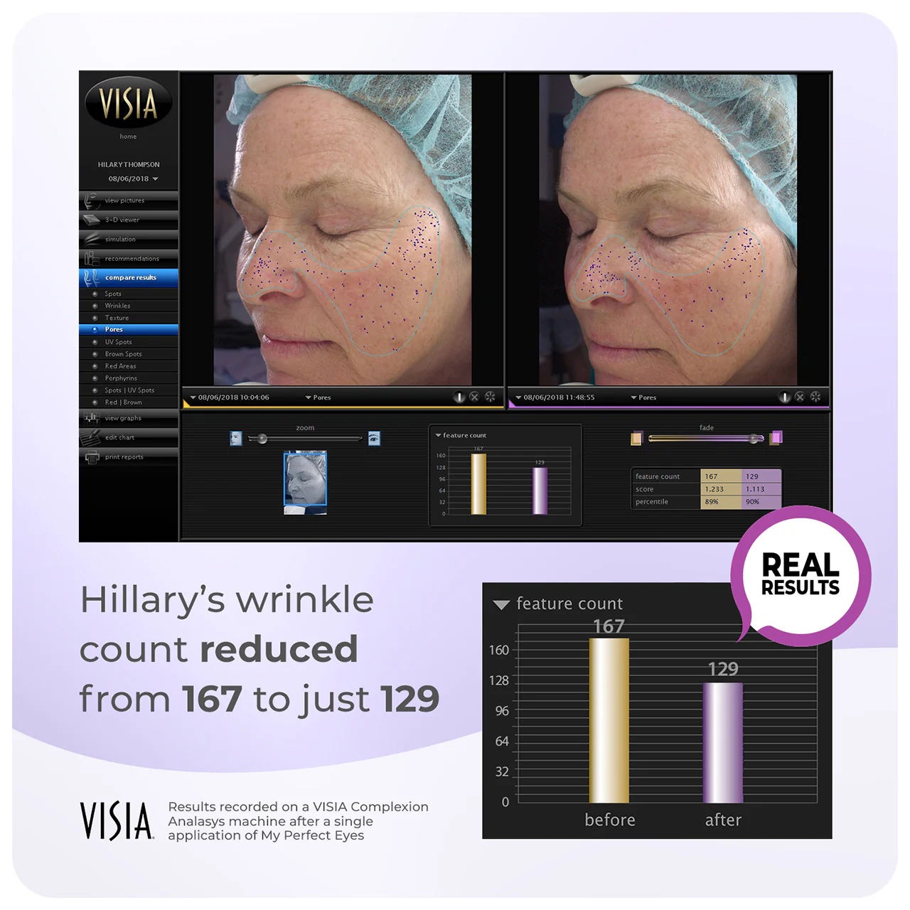 My Perfect Facial 10 Treatments - Image 8