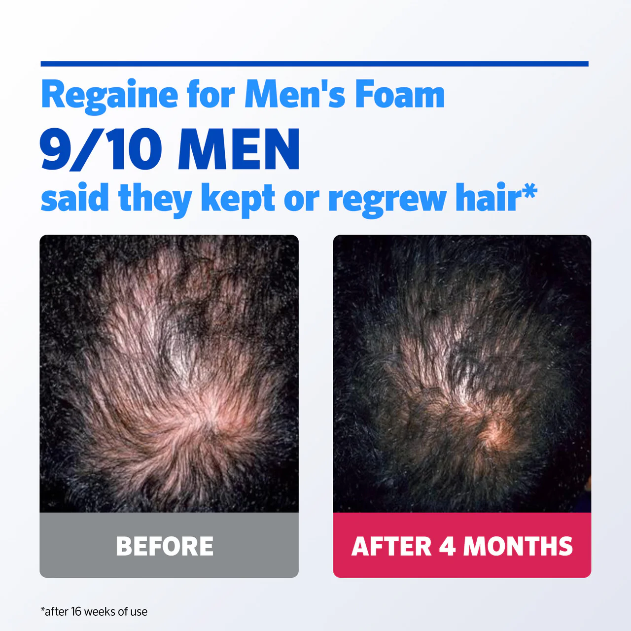 Regaine 5% Extra Strength Hair Regrowth Foam For Men - 3 Month Supply 3x73ml Bottle - Image 10
