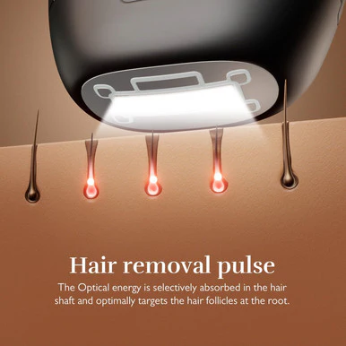 Silk'n 7 IPL Hair Removal Device - Image 3