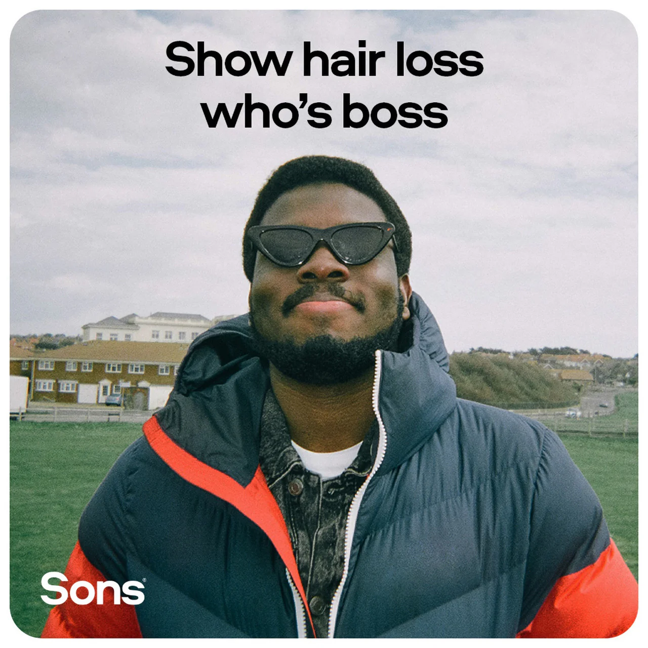 Sons Minoxidil 5% Spray 3 Pack - Image 9