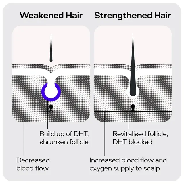 Sons Minoxidil 5% Spray 3 Pack x2 - Image 7