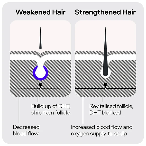 Sons Minoxidil & Shampoo Bundle - Image 5
